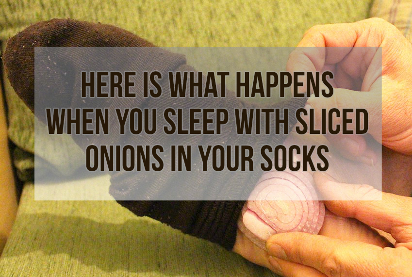 sliced onions in socks