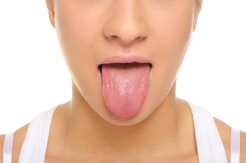 Color of Your Tongue