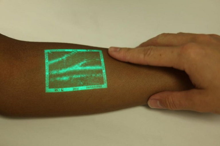 Read more about the article Innovative Vein Visualization Device Makes Drawing Blood Effortless