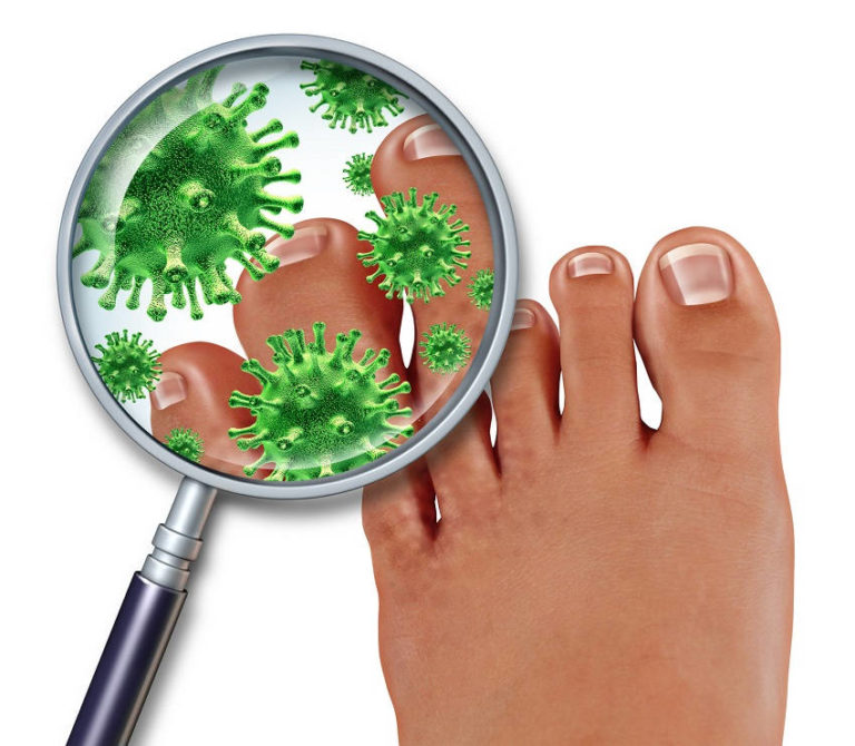 Read more about the article Toenail Fungus May Indicate Your Body Is Full of Toxins – Here Is How to Treat It Naturally