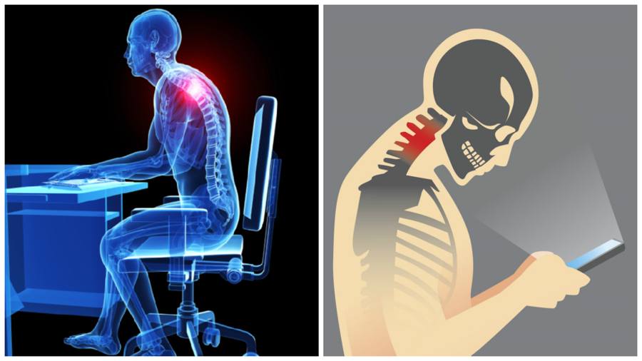 How Sedentary Lifestyle Is Giving You a Hunchback and What 