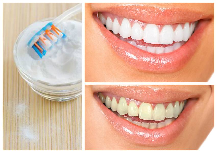 How To Whiten Childs Teeth Naturally