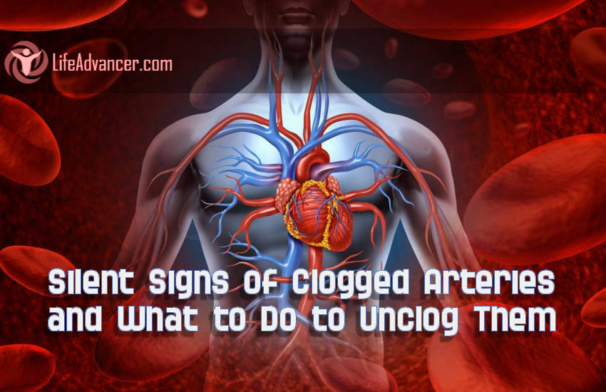 Signs Clogged Arteries What to Do to Unclog