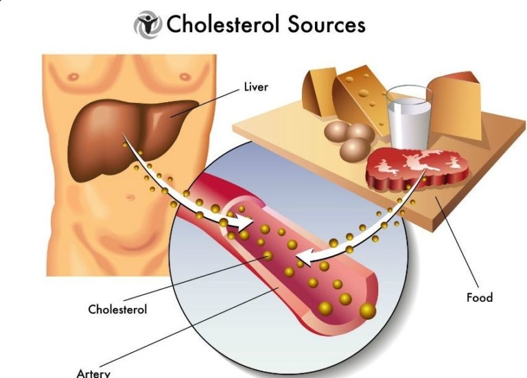 Read more about the article Good Cholesterol and What You Should Know about It