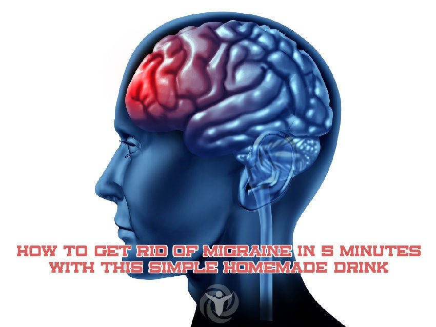 Get Rid of Migraine