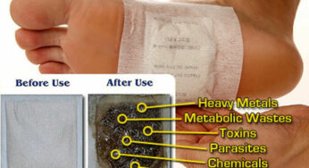 Do Homemade Detox Foot Pads Really Remove Toxins from Your Body?