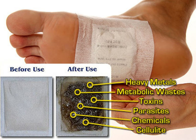 Read more about the article Do Homemade Detox Foot Pads Really Remove Toxins from Your Body?