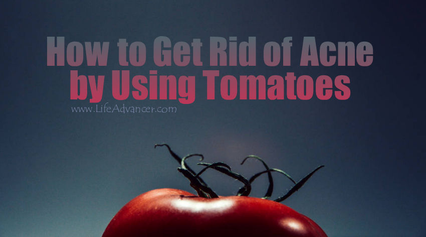 Get Rid of Acne Using Tomatoes