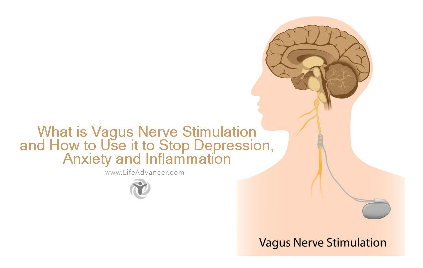 Стимулятор блуждающего нерва. Vagus nerve stimulation. Стимулирование вагуса. Вагус стимулятор блуждающего нерва. Vagus nerve stimulation аппарат.