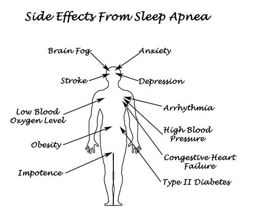 Sife Effects From Sleep Apnea