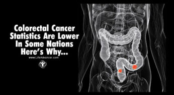 Colorectal Cancer Statistics Are Lower in Some Nations – Here’s Why