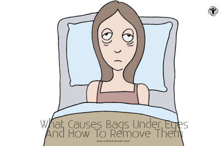 Read more about the article What Causes Bags Under Eyes and How to Remove Them