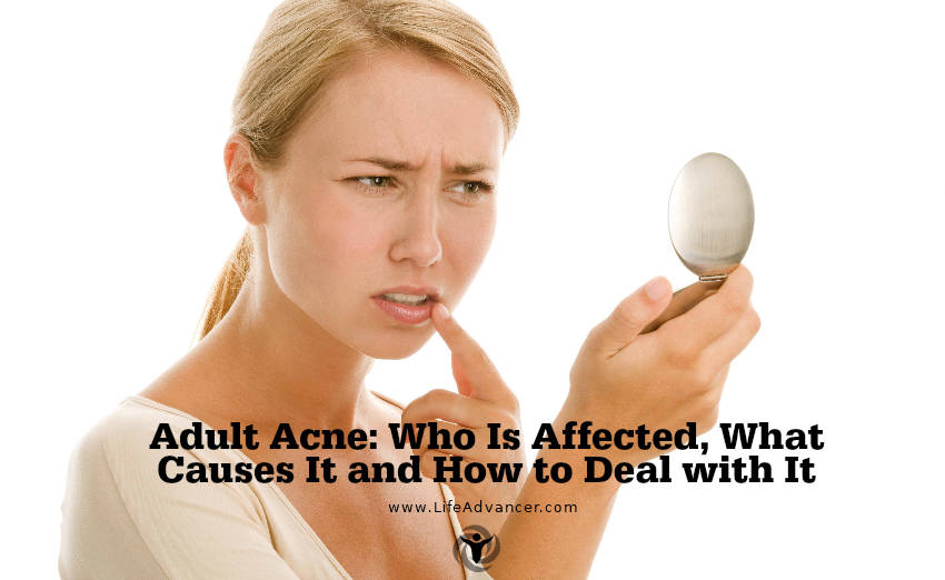 Adult Acne