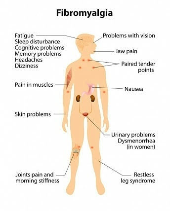 What Causes Fibromyalgia Symptoms