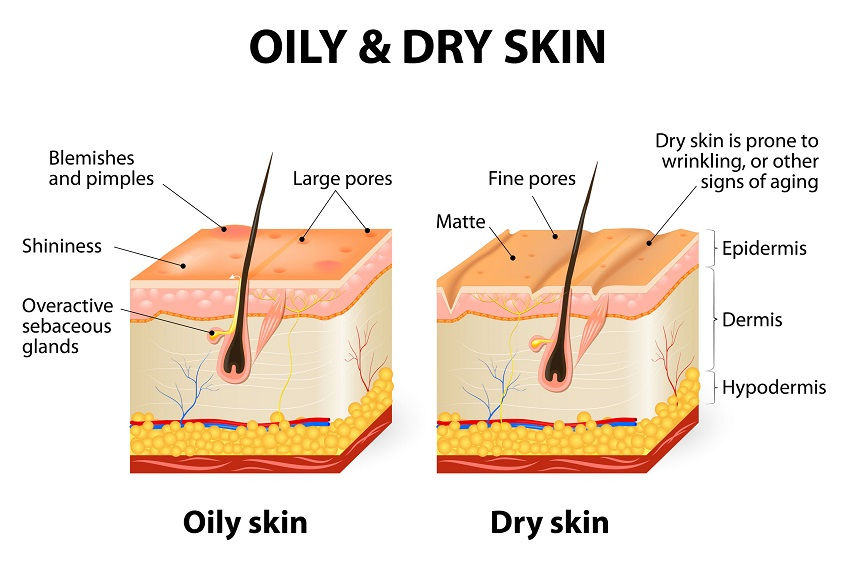 How to Get Rid Of Oily Skin
