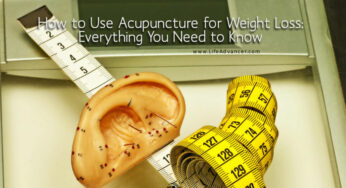 How to Use Acupuncture for Weight Loss: What You Should Know