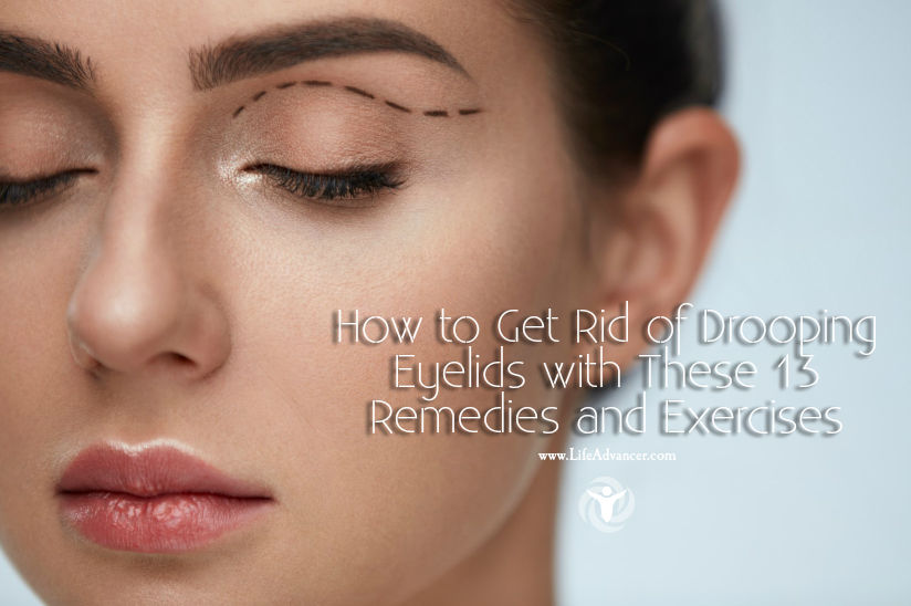 How to Get Rid of Drooping Eyelids